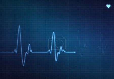 Heartbeat Monitor