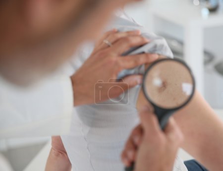 Dermatologist looking at woman's mole